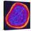 Coloured TEM of a Rubella (German Measles) Virus-PASIEKA-Premier Image Canvas