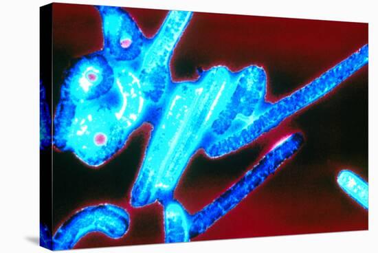 Coloured TEM of Ebola Viruses-Volker Steger-Premier Image Canvas