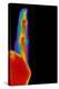 Coloured X-ray of Finger with Rheumatoid Arthritis-Mehau Kulyk-Premier Image Canvas