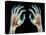 Coloured X-ray of Healthy Human Hands-Science Photo Library-Premier Image Canvas