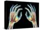 Coloured X-ray of Healthy Human Hands-Science Photo Library-Premier Image Canvas