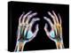 Coloured X-ray of Healthy Human Hands-Science Photo Library-Premier Image Canvas