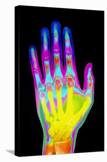 Coloured X-ray of the Healthy Hand of a Man-Mehau Kulyk-Premier Image Canvas