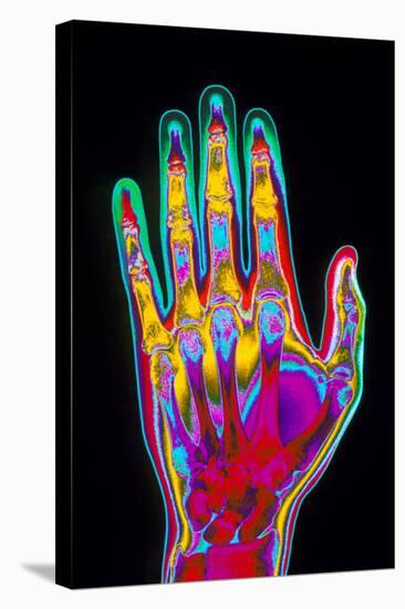 Coloured X-ray of the Healthy Hand of a Man-Mehau Kulyk-Premier Image Canvas