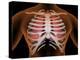 Conceptual Image of Human Lungs and Rib Cage-null-Stretched Canvas