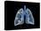 Conceptual Image of Human Lungs-null-Stretched Canvas