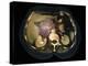 Cystic Pancreas Tumour, CT Scan-ZEPHYR-Premier Image Canvas