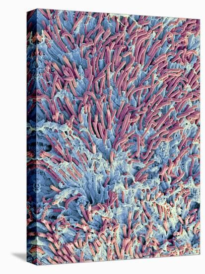 Dental Plaque, SEM-Steve Gschmeissner-Premier Image Canvas