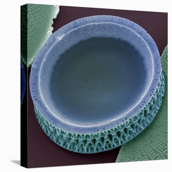 Diatom, SEM-Steve Gschmeissner-Premier Image Canvas