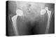 Dislocated Hip Replacement, X-ray-Du Cane Medical-Premier Image Canvas