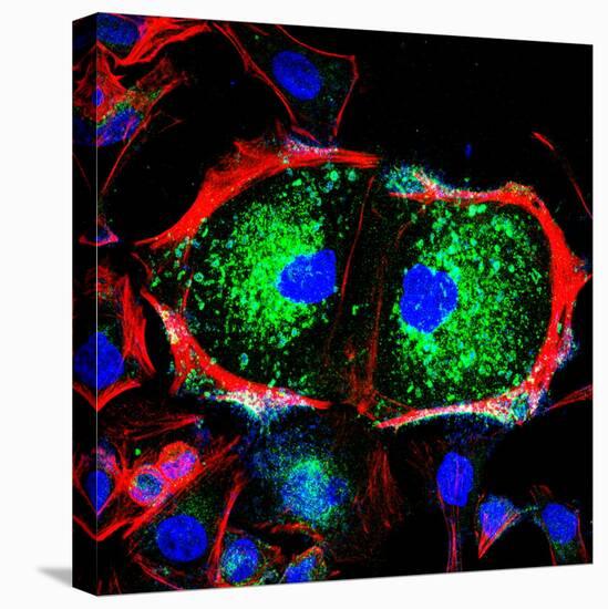 Dividing Cell, Light Micrograph-Science Photo Library-Premier Image Canvas