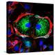 Dividing Cell, Light Micrograph-Science Photo Library-Premier Image Canvas