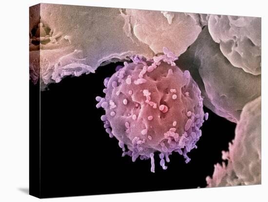 Embryonic Stem Cells, SEM-Steve Gschmeissner-Premier Image Canvas