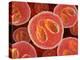 Eosinophil White Blood Cells, Artwork-David Mack-Premier Image Canvas