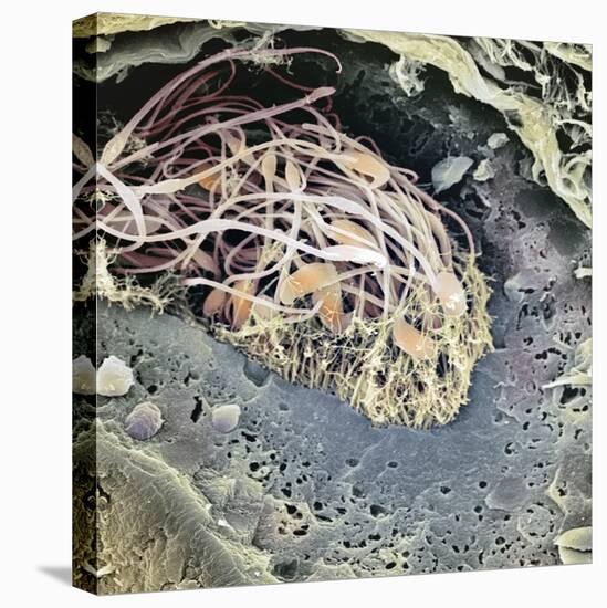 Epididymis, SEM-Steve Gschmeissner-Premier Image Canvas