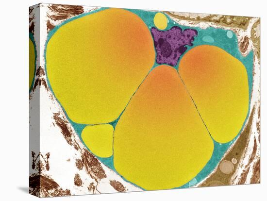 Fat Cell, TEM-Steve Gschmeissner-Premier Image Canvas