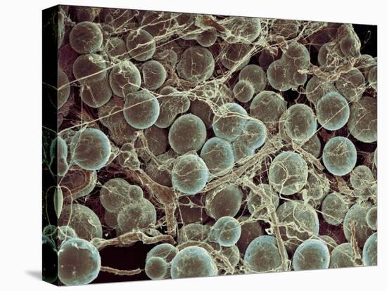 Fat Cells, SEM-Steve Gschmeissner-Premier Image Canvas
