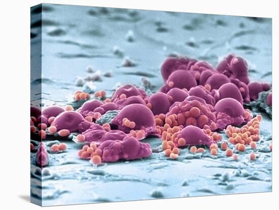 Fat Cells, SEM-Science Photo Library-Premier Image Canvas
