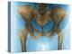 Female Pelvis, X-ray-Du Cane Medical-Premier Image Canvas