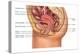 Female Reproductive Anatomy, Illustration-Gwen Shockey-Premier Image Canvas