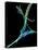 Fibroblast Cells, Fluorescent Micrograph-Dr. Torsten Wittmann-Premier Image Canvas