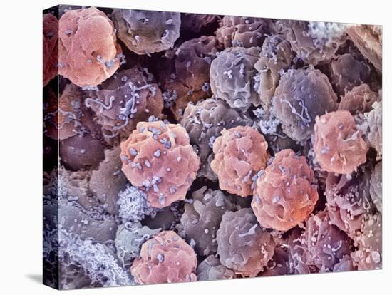 Foetal Blood Stem Cells, SEM-Steve Gschmeissner-Premier Image Canvas