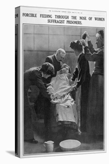 Forcible Feeding Through the Nose of Women Suffragist Prisoners-null-Premier Image Canvas