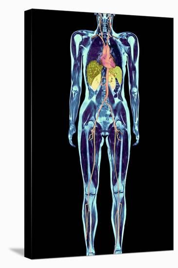 Full Body Scan, MRI Scan-Volker Steger-Premier Image Canvas