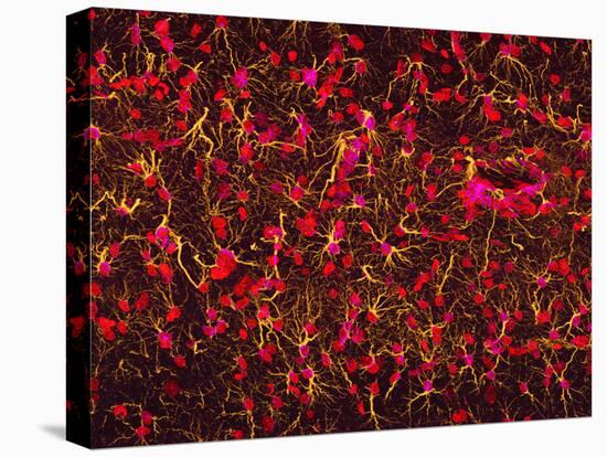 Glial Cells-Thomas Deerinck-Premier Image Canvas