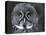 Great Grey Owl Portrait, Alaska, USA-Lynn M. Stone-Premier Image Canvas