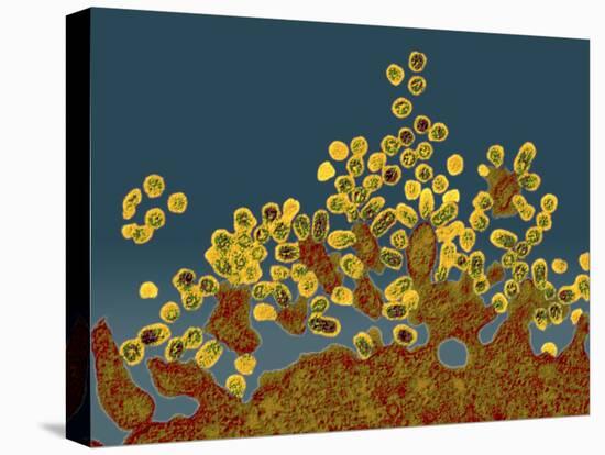 H1N1 Swine Flu Virus, TEM-Dr. Klaus Boller-Premier Image Canvas