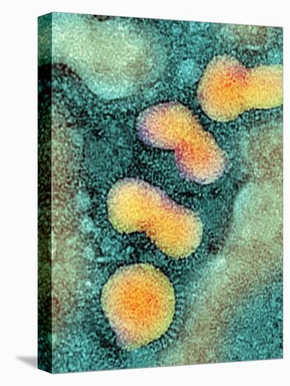 H5N1 Avian Influenza Virus Particles, TEM-NIBSC-Premier Image Canvas