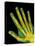 Healthy Adult Hand, X-ray-Science Photo Library-Premier Image Canvas