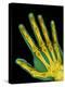 Healthy Adult Hand, X-ray-Science Photo Library-Premier Image Canvas