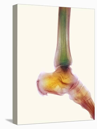 Healthy Ankle, X-ray-Science Photo Library-Premier Image Canvas