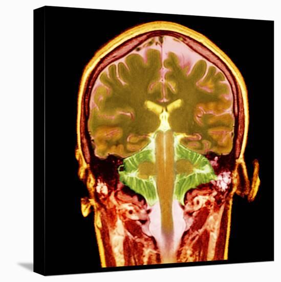 Healthy Brain, MRI Scan-Science Photo Library-Premier Image Canvas