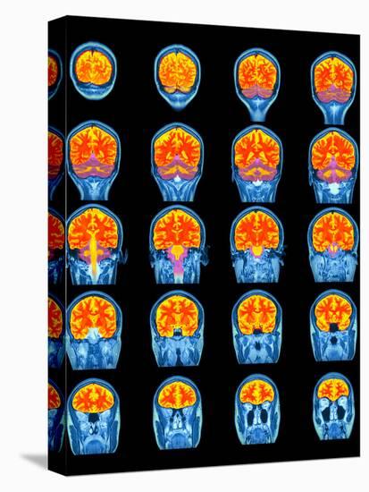 Healthy Brain, MRI Scans-Science Photo Library-Premier Image Canvas