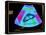 Healthy Kidney Measured, Ultrasound Scan-Science Photo Library-Premier Image Canvas