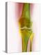 Healthy Knee, X-ray-Science Photo Library-Premier Image Canvas