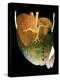 Healthy Liver, CT Scan-ZEPHYR-Premier Image Canvas