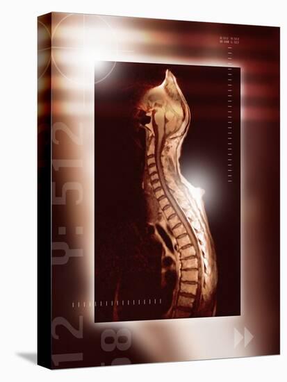 Healthy Spine, MRI Scan-Miriam Maslo-Premier Image Canvas