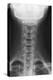 Healthy Spine of the Neck, X-ray'-Du Cane Medical-Premier Image Canvas