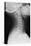 Healthy Spine of the Neck, X-ray'-Du Cane Medical-Premier Image Canvas