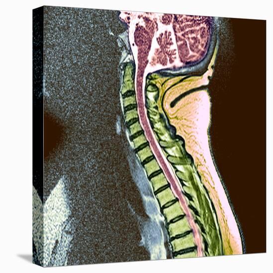Healthy Spine-Du Cane Medical-Premier Image Canvas