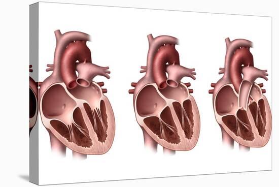 Heart Valves, Artwork-Henning Dalhoff-Premier Image Canvas