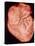 Heart with Arteries-Science Photo Library-Premier Image Canvas