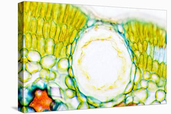 Heather Leaf Stomata, Light Micrograph-Dr. Keith Wheeler-Premier Image Canvas