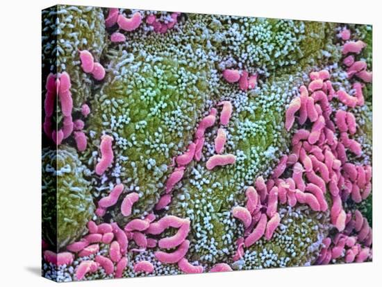 Helicobacter Pylori Bacteria In Stomach-null-Premier Image Canvas