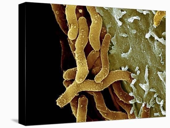 Helicobacter Pylori Bacteria, SEM-Science Photo Library-Premier Image Canvas