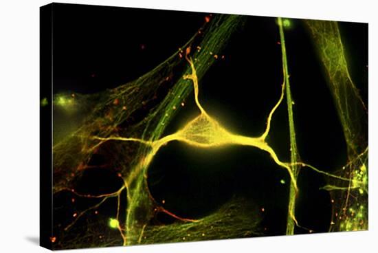 Hippocampal Neuron Fluorescent Micrograph-Robert Mcneil-Premier Image Canvas